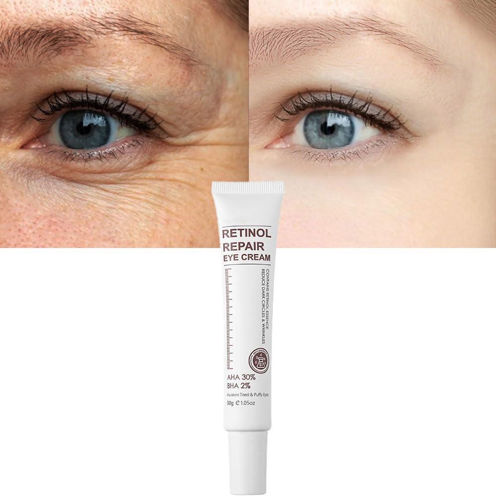 Under Eye Cream Showdown: Hydration vs. Retinol Power